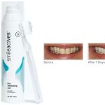 Smileactives Reviews - Smileactives Pro Whitening Gel Amazon
