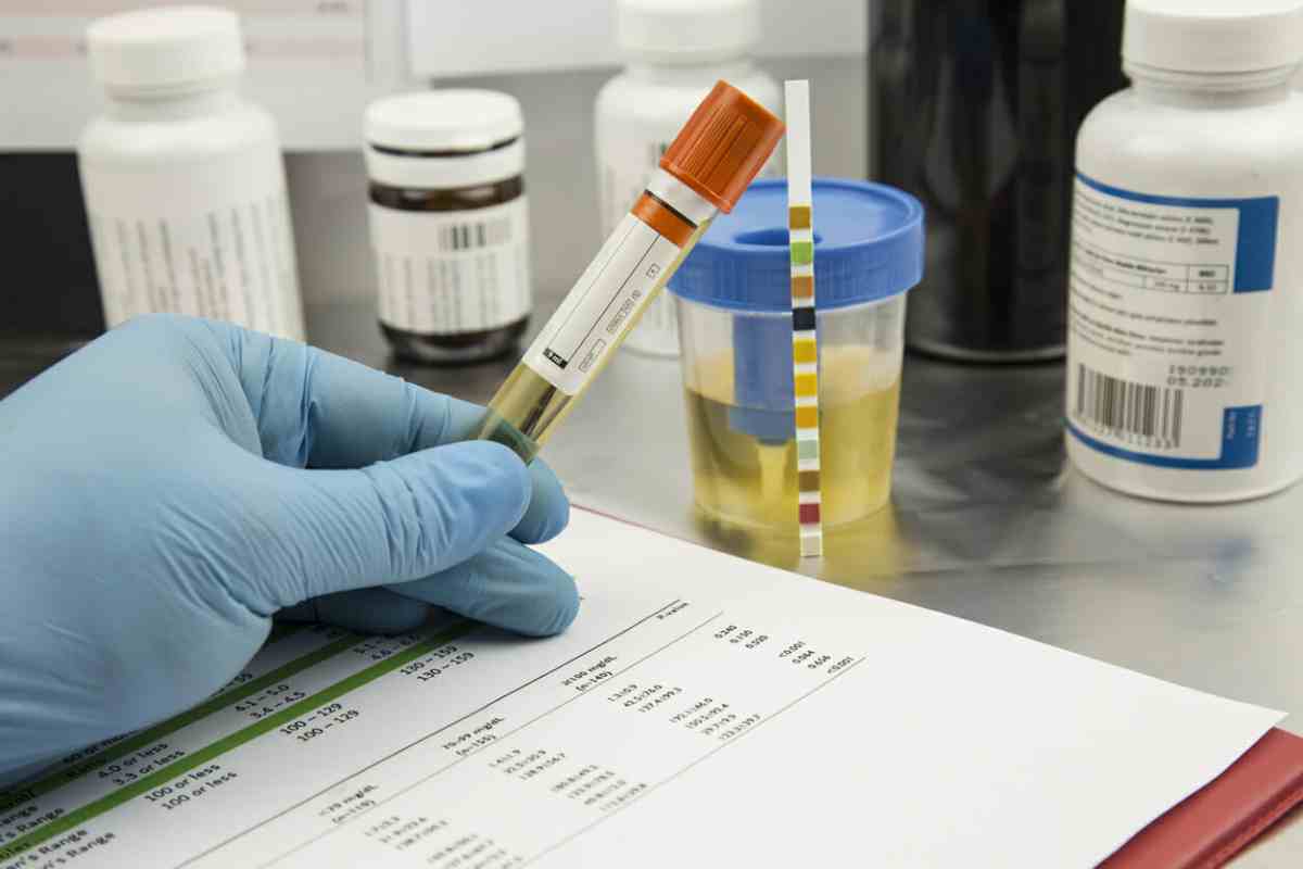 Choosing Reliable Drug Testing Services for Addiction Treatment in Texas